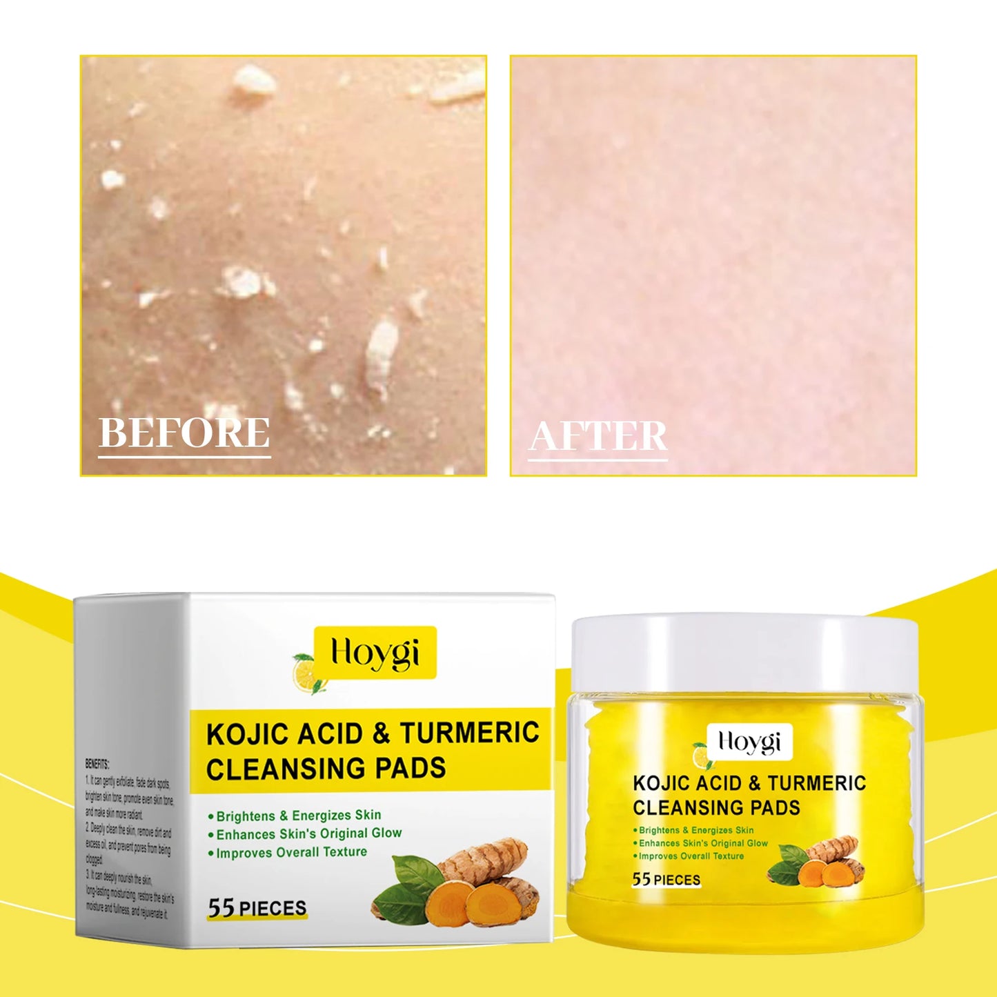 4PCS Turmeric Cleansing Skincare Exfoliating Pads, Gentle Formula, Suitable for All Skin Types [55PCS/Bottle]