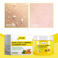 4PCS Turmeric Cleansing Skincare Exfoliating Pads, Gentle Formula, Suitable for All Skin Types [55PCS/Bottle]